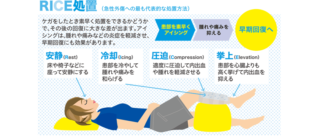 【RICE処置(急性外傷への最も代表的な処置方法)】ケガをしたとき素早く処置をできるかどうかで、その後の回復に大きな差が出ます。アイシングは、腫れや痛みなどの炎症を軽減させ、早期回復にも効果があります。患部を素早くアイシング>腫れや痛みを抑える>早期回復へ・安静(Rest)床やいすなどに座って安静にする・冷却(Icing)患部を冷やして腫れや痛みを和らげる・圧迫(Compression)適度に圧迫して内出血や腫れを軽減させる・拳上(Elevation)患部を心臓よりも高く挙げて内出血を抑える